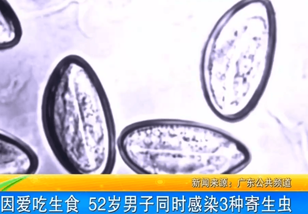 女子体内排出10米长绦虫<strong></p>
<p>eth矿池</strong>！原是两年前旅游时吃了这种食物