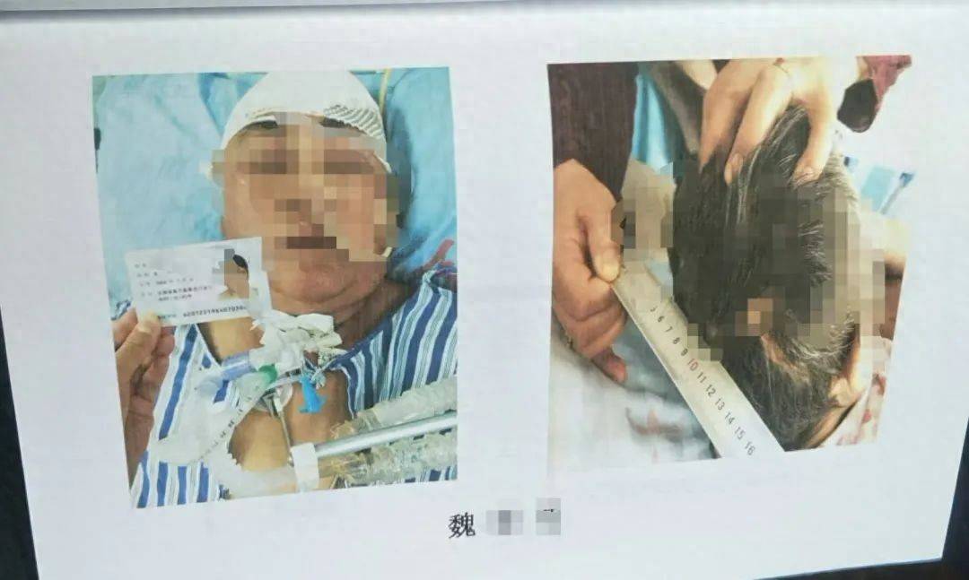 目睹母亲过马路被车撞<strong></p>
<p>eth交易平台</strong>，27岁女子受惊吓5天后身亡
