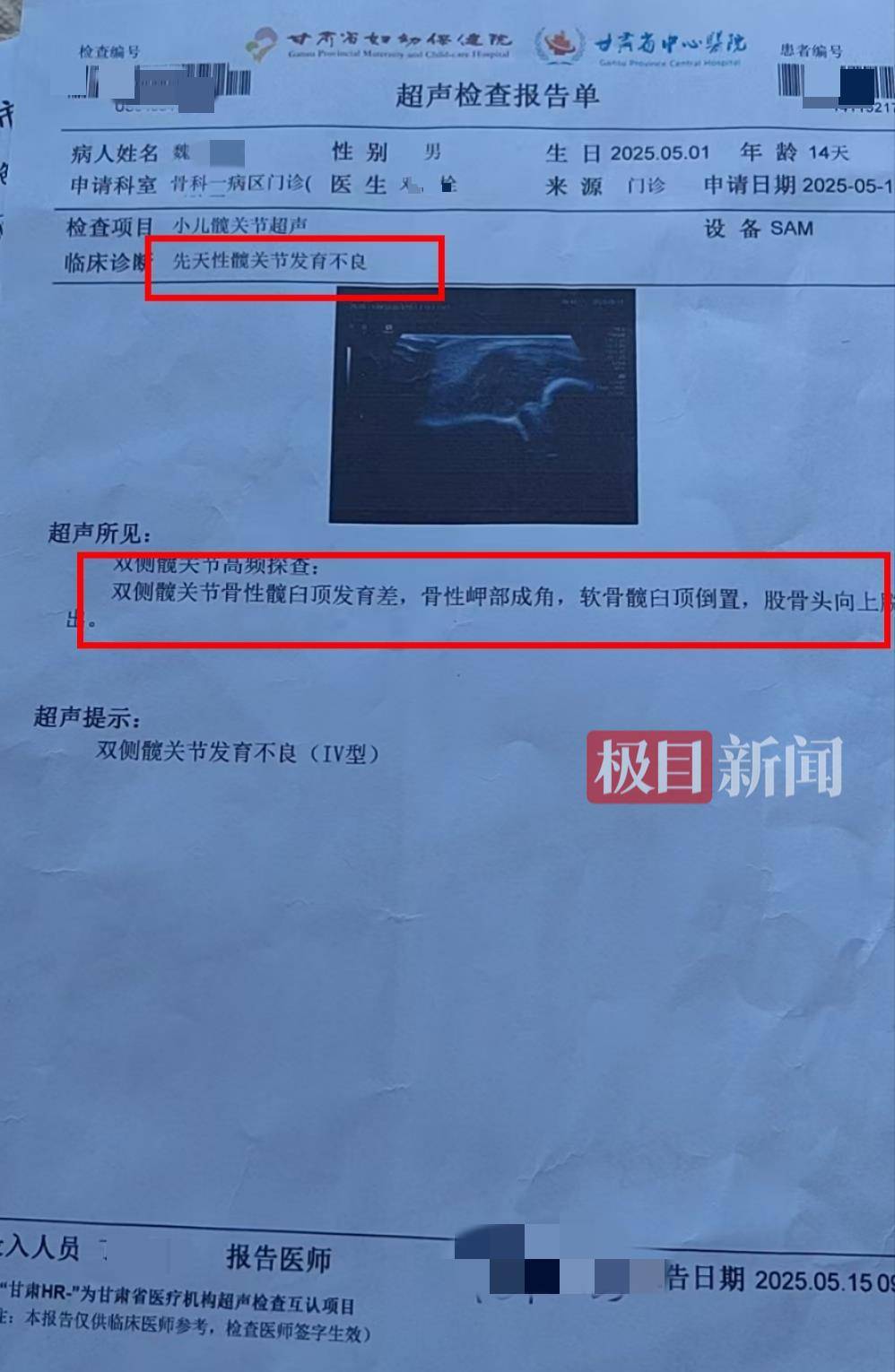 二胎出生查出先天性病症或落下残疾<strong></p>
<p>1比特币多少人民币</strong>，残疾父母称医院产检漏检、未尽告知义务，医院及医调委回应