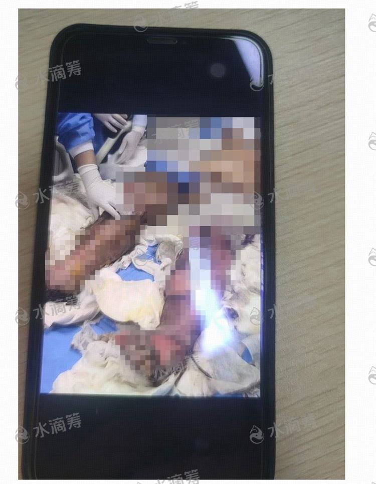 成都一小区电瓶车楼道“飞线充电”酿火灾<strong></p>
<p>币安api</strong>，一家四口1死2伤，涉事车主被刑拘