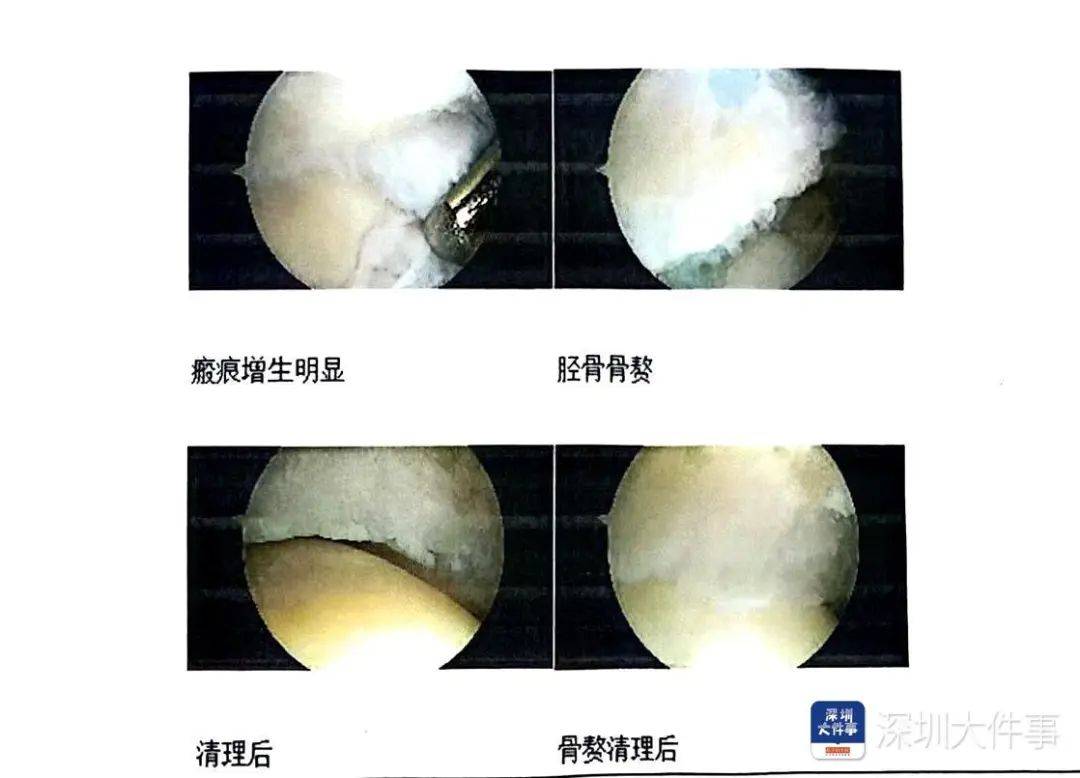 “一走路就痛”！女子脚踝受伤遭漏诊<strong></p>
<p>币安api</strong>，治了7年没好！深圳一医院被告上法庭