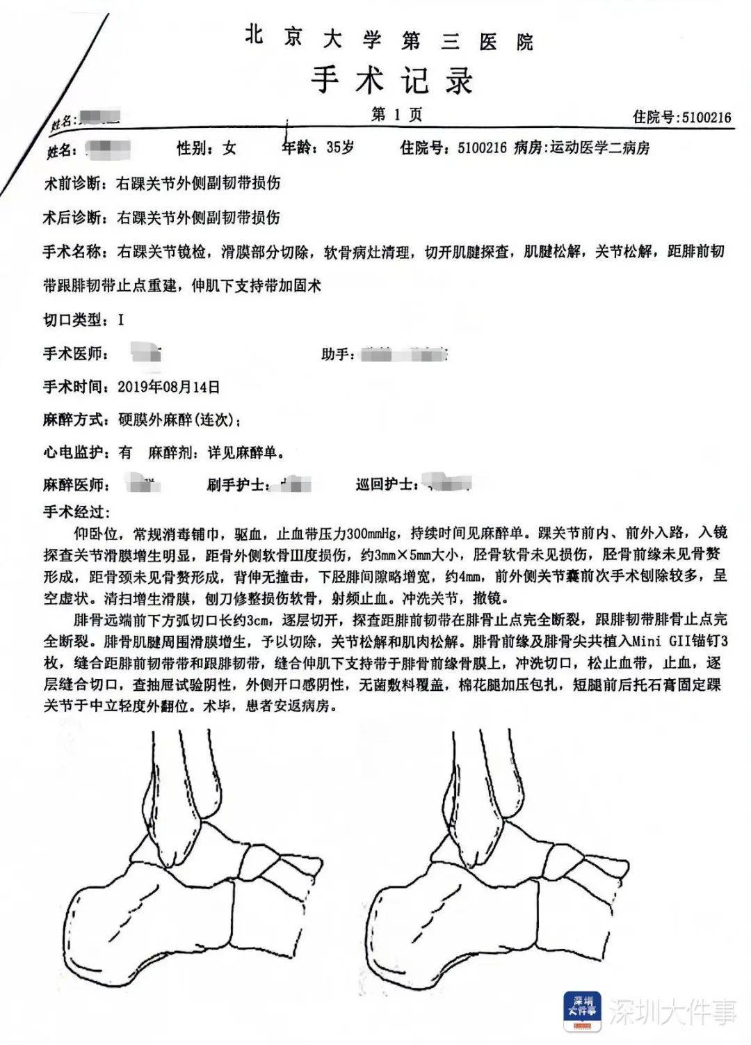 “一走路就痛”！女子脚踝受伤遭漏诊<strong></p>
<p>币安api</strong>，治了7年没好！深圳一医院被告上法庭