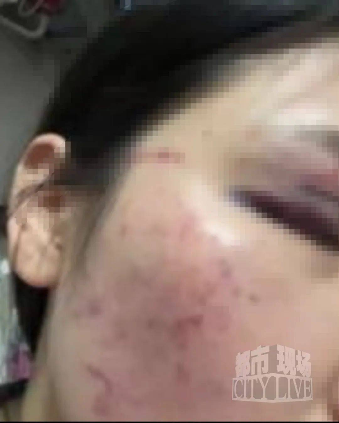 湖南衡阳29岁女子疑被男友施暴后从25楼跳下身亡 男友徐某此前还刺激说：“你放心<strong></p>
<p>狗币</strong>，她不会去死的”