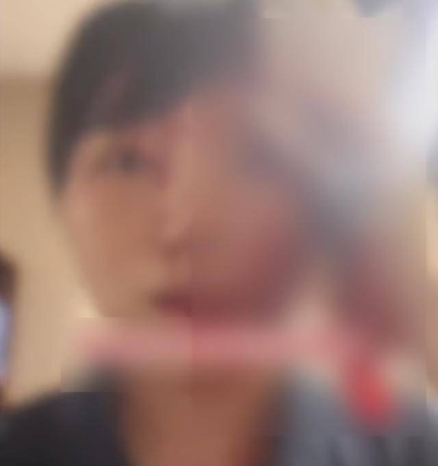 缝了20多针！女子称被不知名男同事砸头毁容<strong></p>
<p>狗狗币价格今日行情</strong>，警方介入