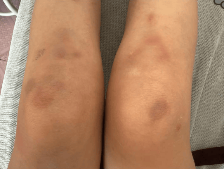 女子自称因工资问题被老板锁办公室里打 警方：双方已到派出所<strong></p>
<p>火币网下载</strong>，是否打人还在调查