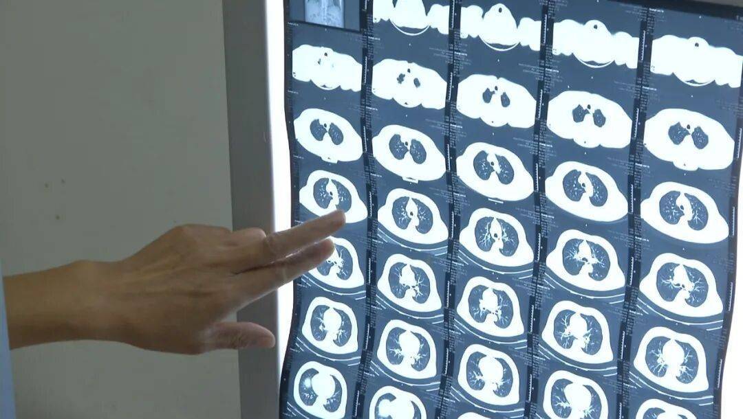 许多患者没有症状<strong></p>
<p>莱特币</strong>，发病就猝死！警惕这种心脏疾病