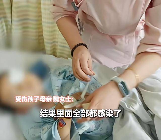 江西一5岁男孩在幼儿园被戳伤致左眼失明<strong></p>
<p>欧易交易所</strong>，家长称老师用猪油涂抹试图消肿