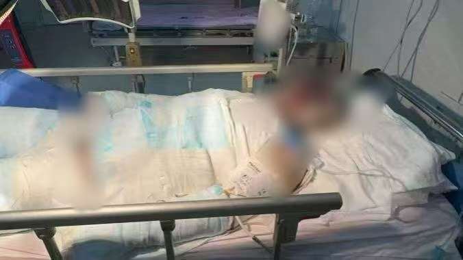 父子在哈尔滨一亲戚公司上班遇爆炸全身烧伤<strong></p>
<p>欧易下载</strong>，治疗花费近百万公司拒赔偿？亲戚回应