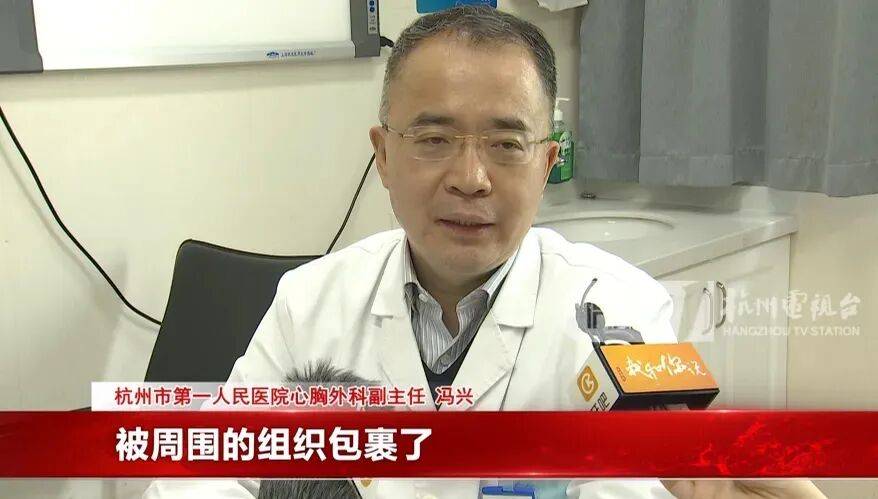 17岁小伙参军体检发现胸腔内有根5cm缝衣针<strong></p>
<p>虚拟货币是什么</strong>,父母回忆或是1岁时扎入,取出时已锈迹斑斑